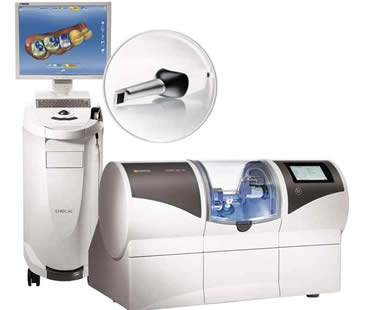 Key Features of CEREC Crown Technology