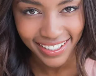 Porcelain Veneers