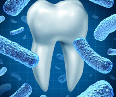 Causes and Effects of Gingivitis